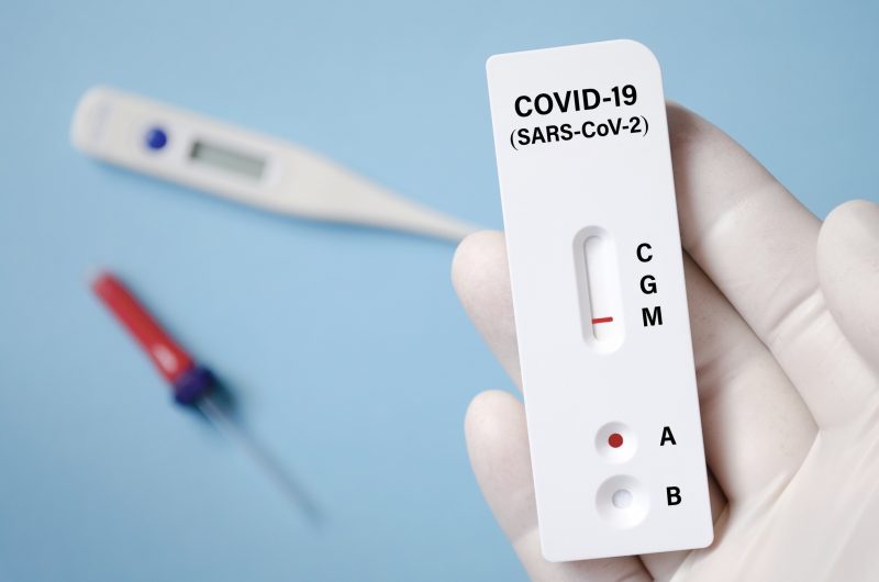 Komercyjne testy wymazowe w kierunku COVID-19